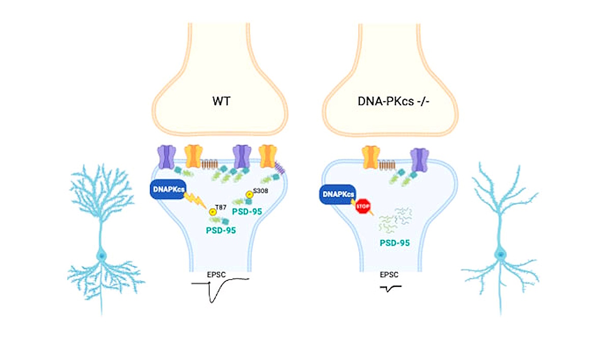 Alzheimer: uno studio di ricercatori italiani ipotizza la causa della perdita di memoria tipica dell'Alzheimer e di altre demenze