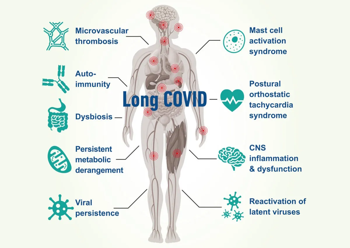 Cinque anni dopo il COVID: l’ombra lunga del Long COVID sulla sanità pubblica